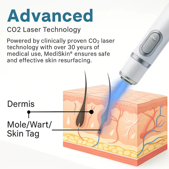 MedSkin Laser