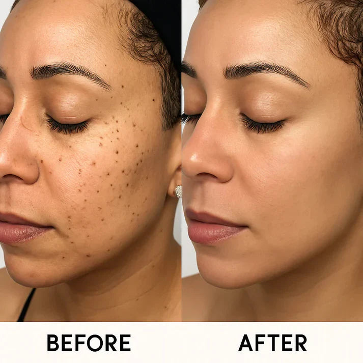 MedSkin Laser