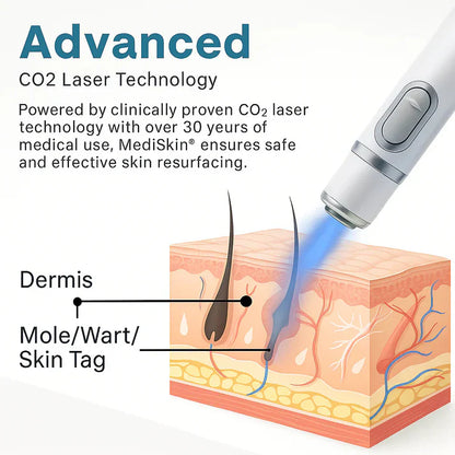 MedSkin Laser