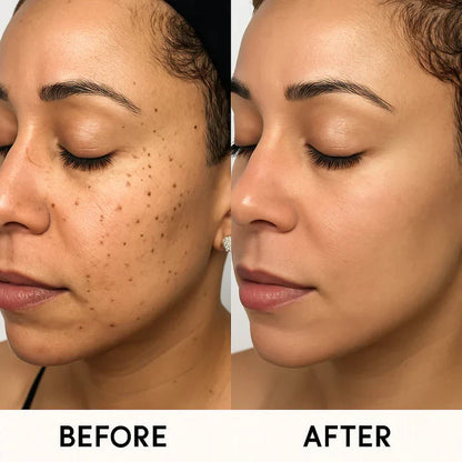 MedSkin Laser